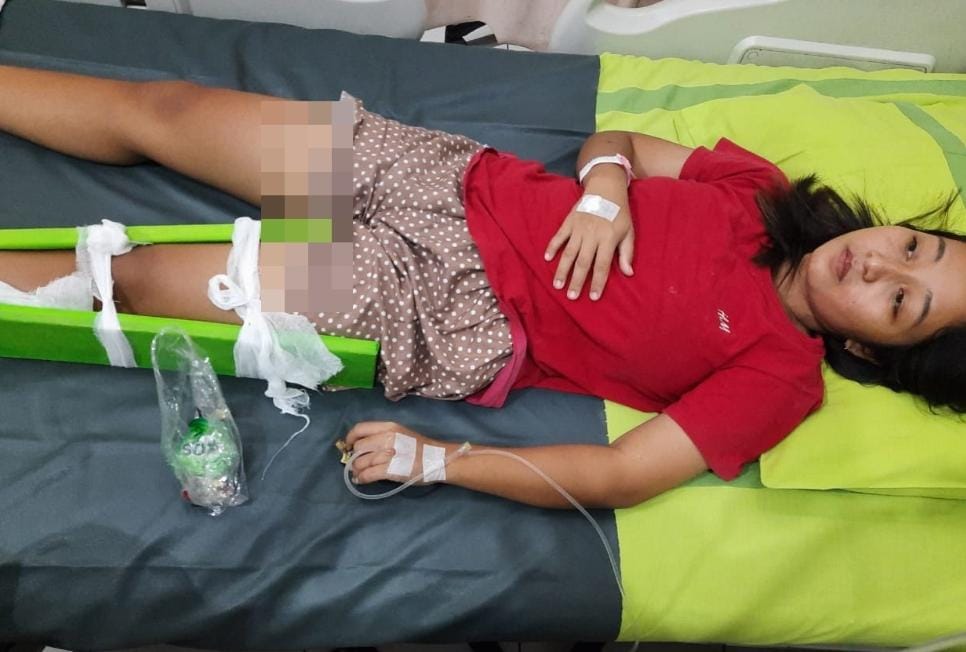 DIRAWAT: Korban luka Indri Tiasari, warga Tenggang, Kemadang, Tanjungsari, menjalani perawatan di RSUD Wonosari karena patah kaki. (Dok BPBD Gunungkidul)