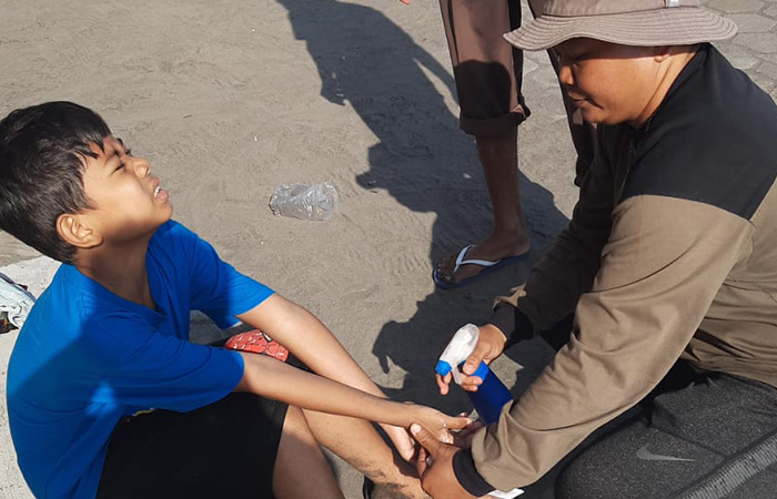 EVAKUASI:&nbsp;Korban sengatan ubur-ubur api di Pantai Parangtritis saat dilakukan penanganan oleh petugas SAR Satlinmas Wilayah III.