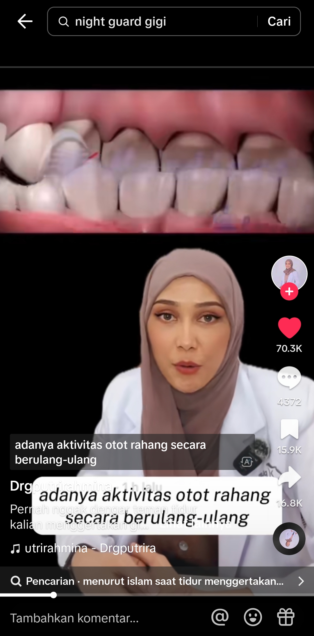 Kondisi menggertakan gigi waktu tidur. Posisi rahang atas dan bawah saling bergesekan rawan gigi menjadi aus. (Tiktok/@drgputrirahmina)