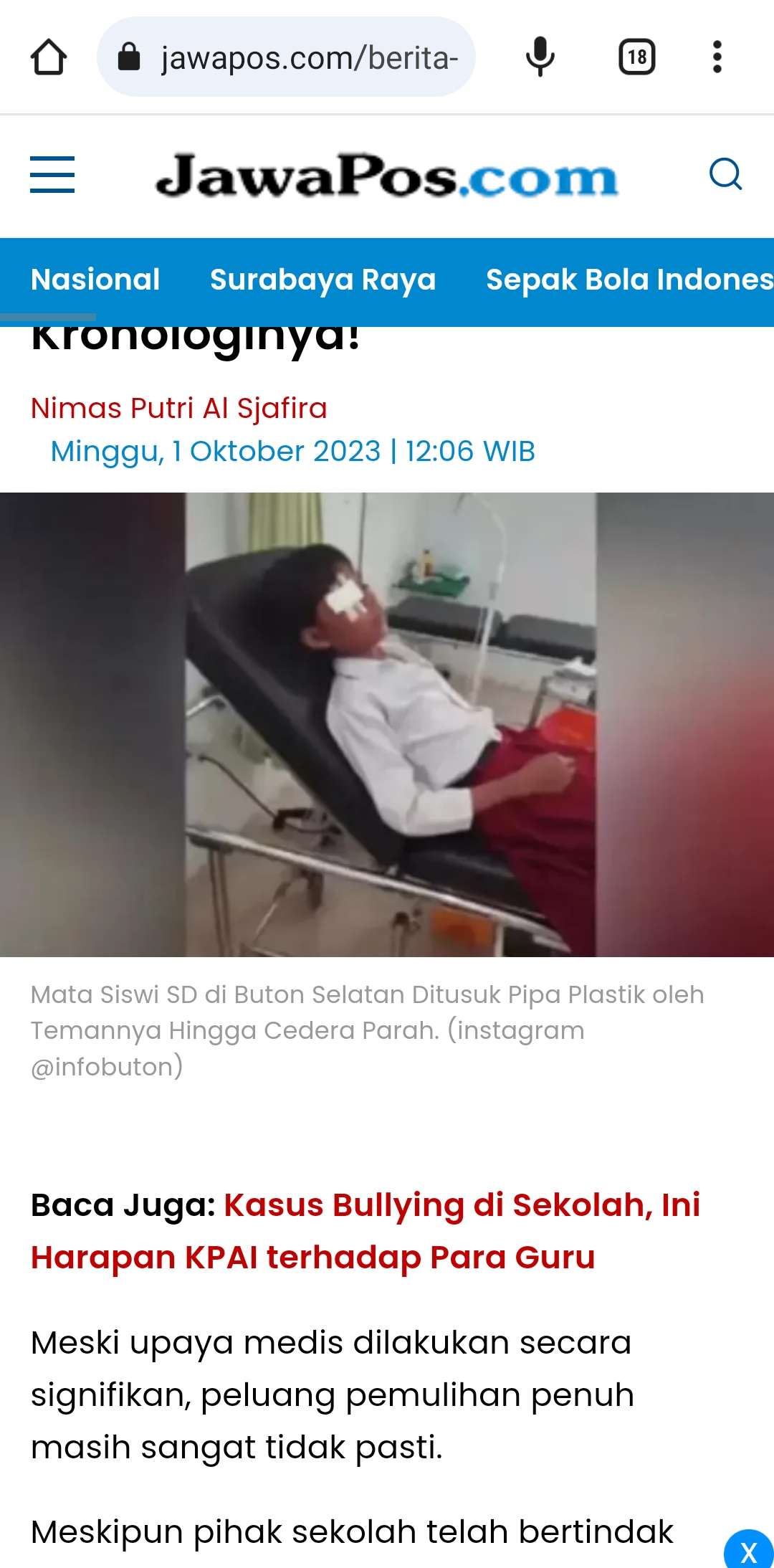 Mata siswi SD di Buton Selatan ditusuk pipa plastik oleh temannya. Kini dalam perawatan medis, korban terancam buta. (Instagram/@infobuton)