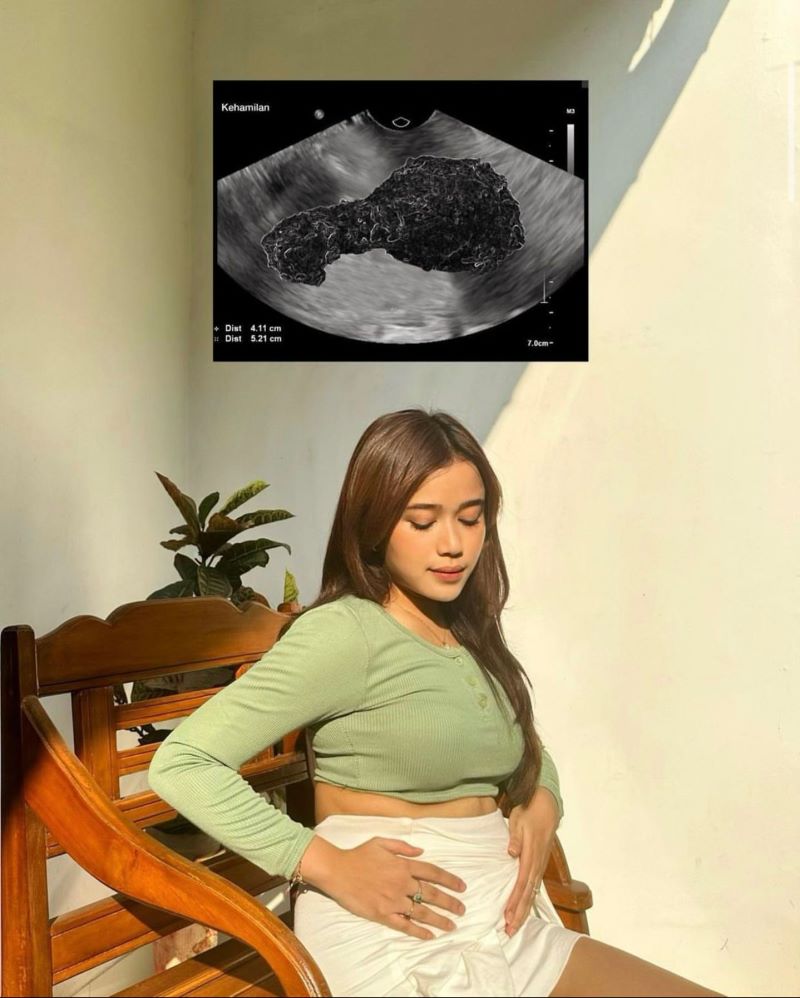 Foto : Foto Brisia Jodie memegang perut. (Instagram @brisiajodie96)