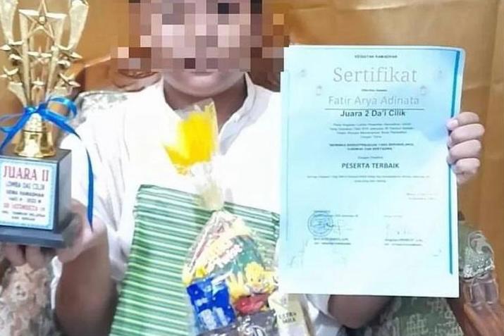 Foto: FAA siswa SDN 9 Jatimulya Bekasi korban bullying (Instagram @lets.talkendenjoy)