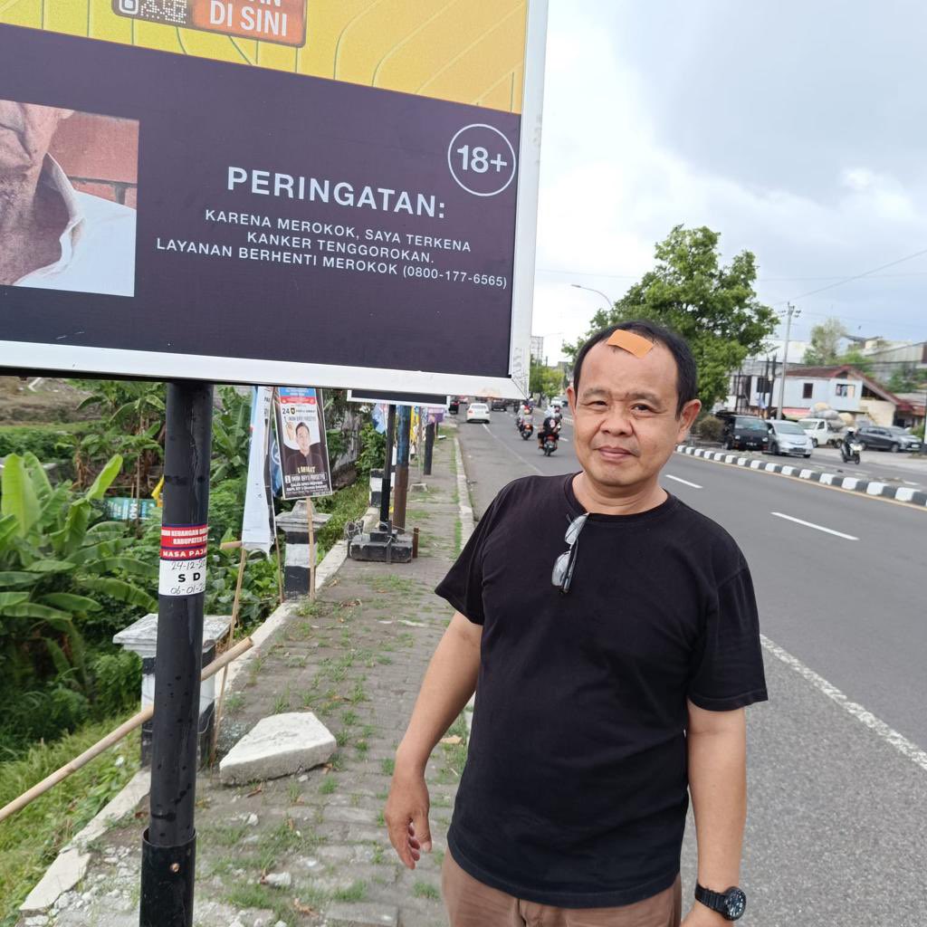 Puji Widodo berpose dengan kepala yang terluka karena terkena papan reklame di Jalan Laksda Adisucipto Sleman Selasa (2/1)