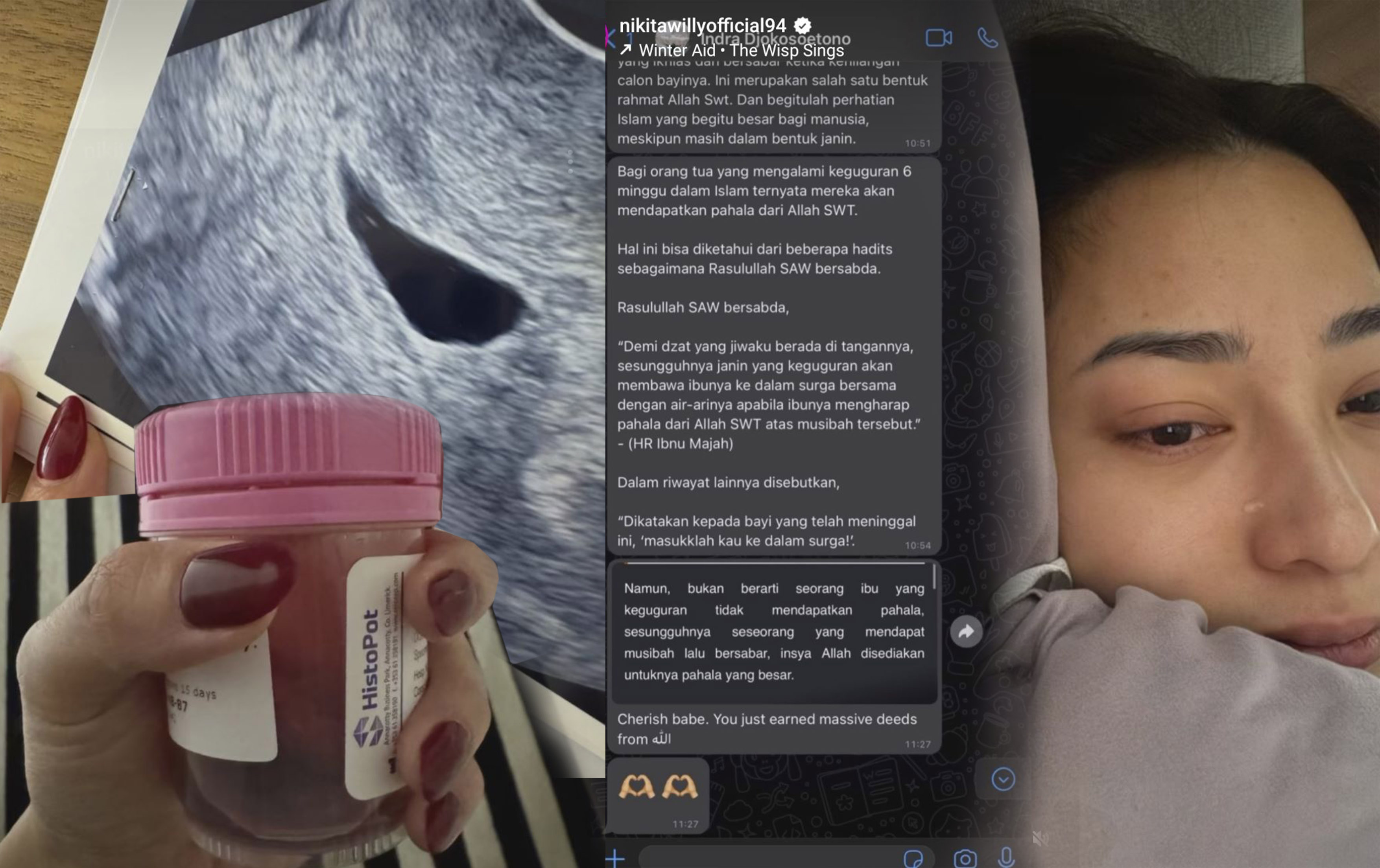 Artis Nikita Willy umumkan keguguran anak keduanya disaat janin berusia 7 minggu.