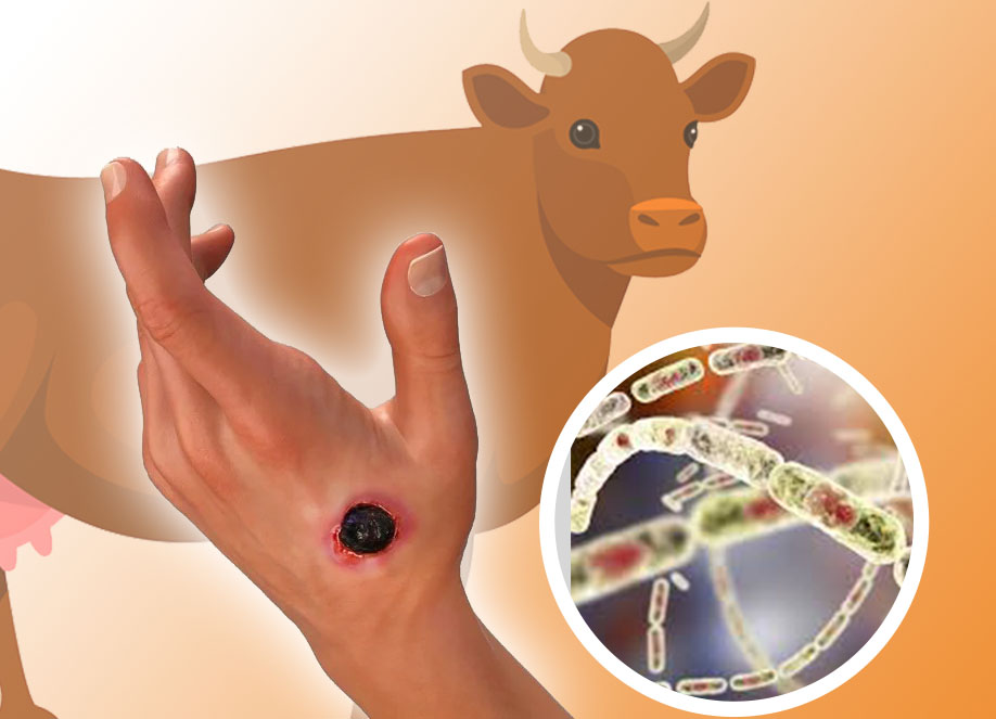 Ilustrasi Antraks. Kasus antraks kembali terjadi di Gunungkidul