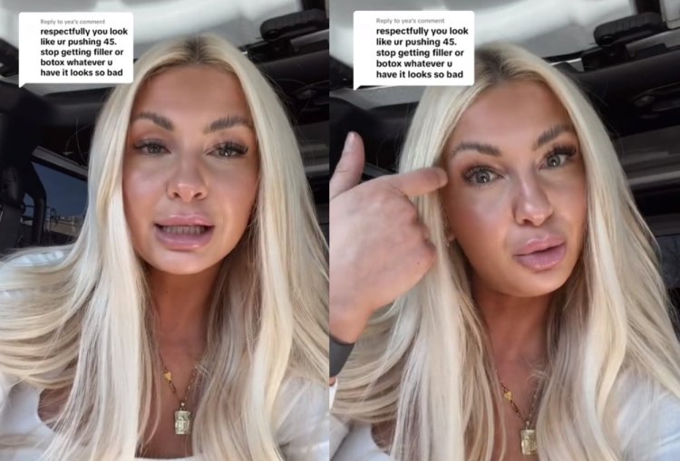 Keseringan Botox, Wanita Usia 22 Ini Dikira Sudah 45 Tahun. Gambar : Kolase Tangkapan Layar Tiktok/@shawnono