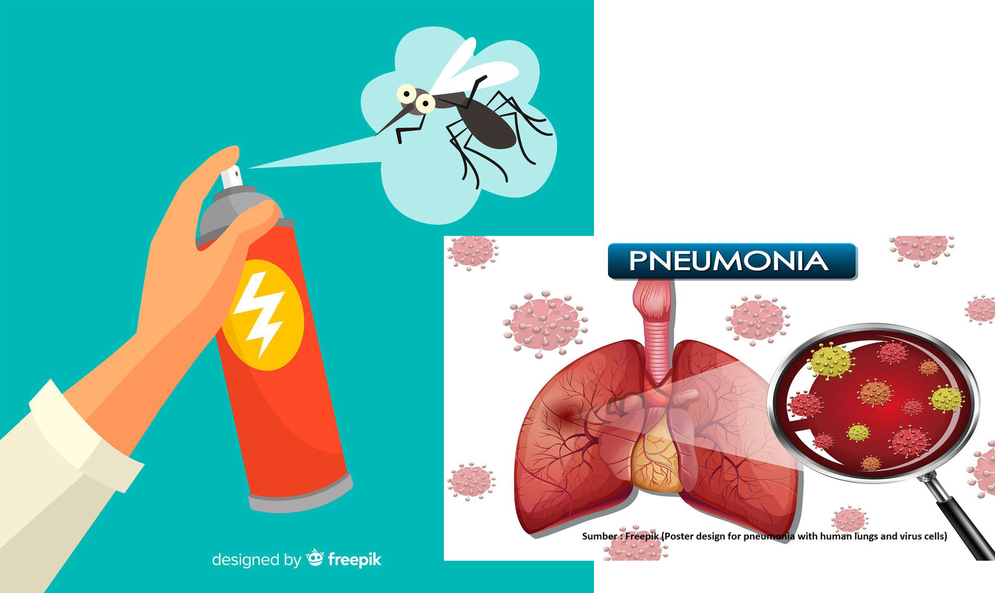 Ilustrasi bahaya obat nyamuk semprot bagi kesehatan. Salah satunya bisa menyebabkan Pneumonia.