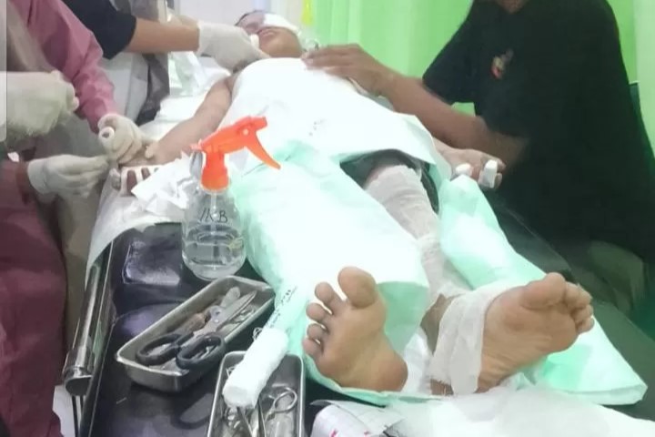 Caption Foto : Anak yang terkena ledakan petasan di Slogohimo, Kabupaten Wonogiri dirawat di rumah sakit