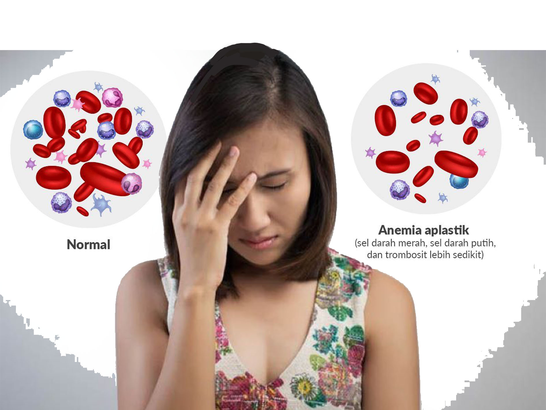 Ilustrasi seseorang lemas mengalami anemia.