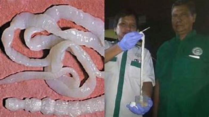 Parasit yang hidup dalam tubuh manusia