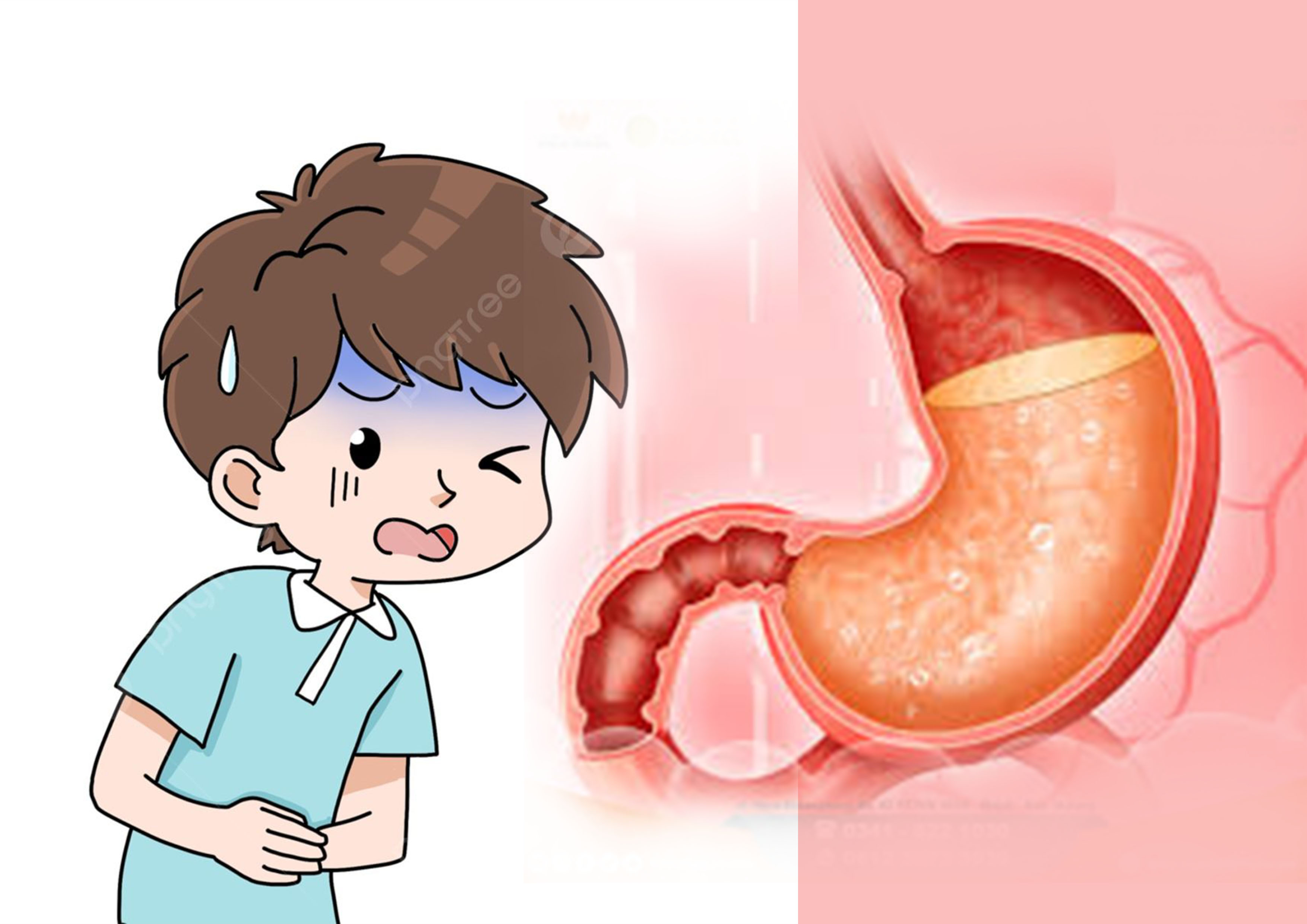 Ilustrasi keringat dingin dan asam lambung.