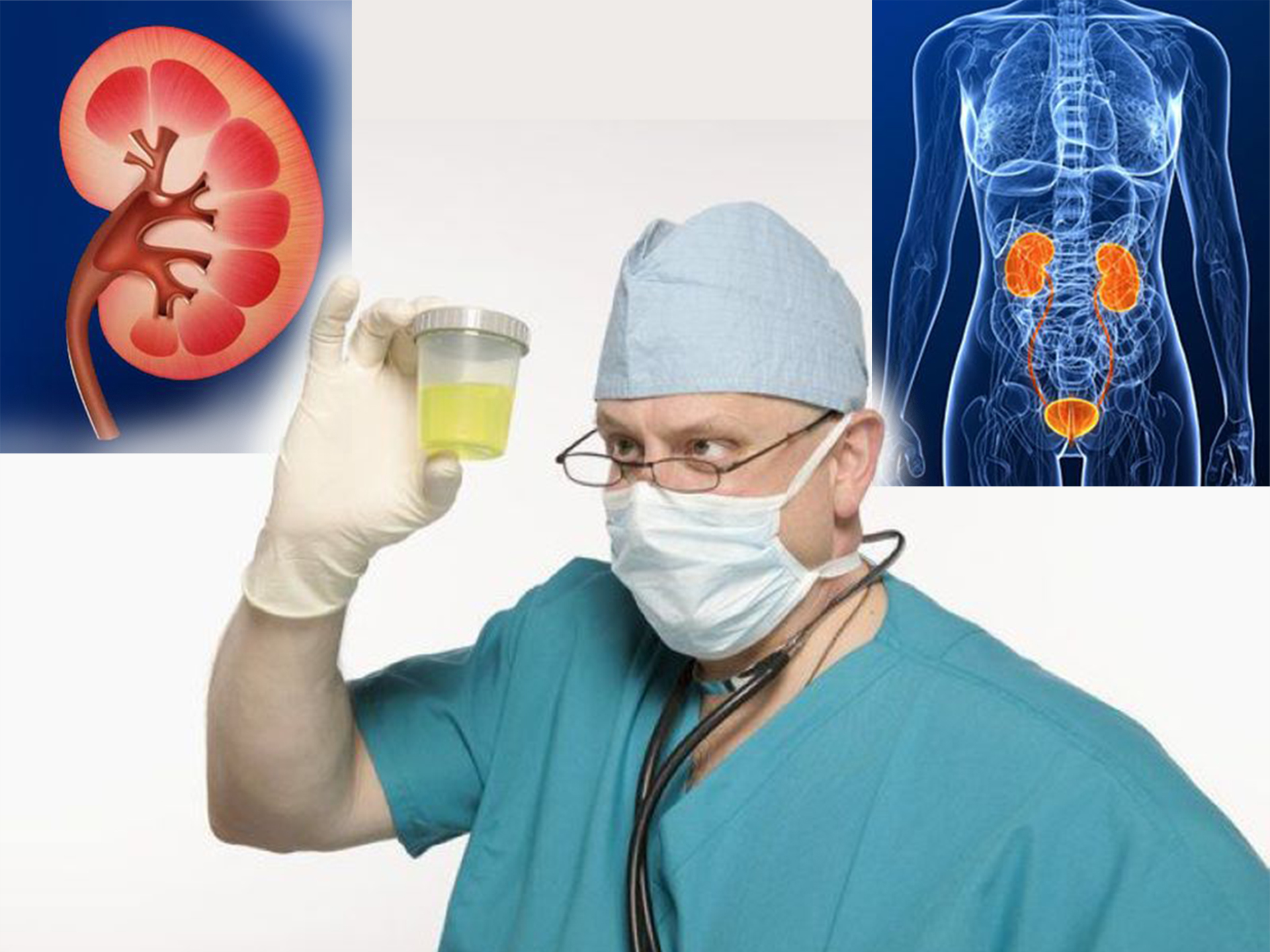 Ciri urine pada penderita ginjal bermasalah.