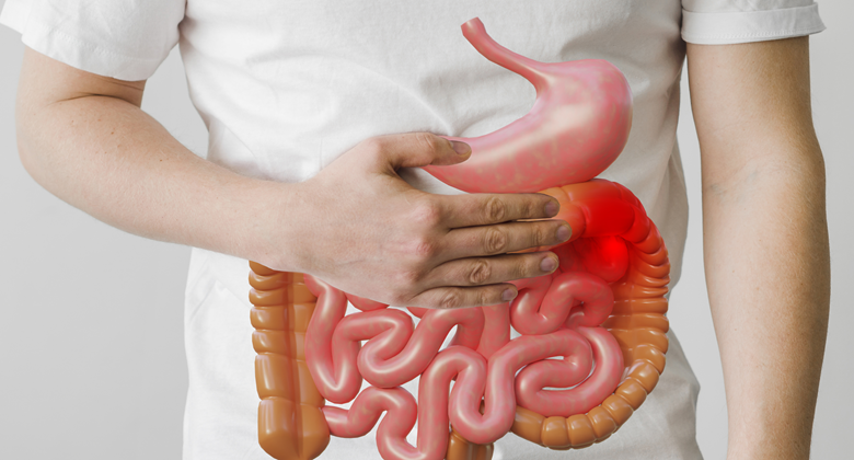 Ilustrasi Usus Buntu.