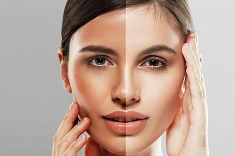 Ilustrasi kulit belang.