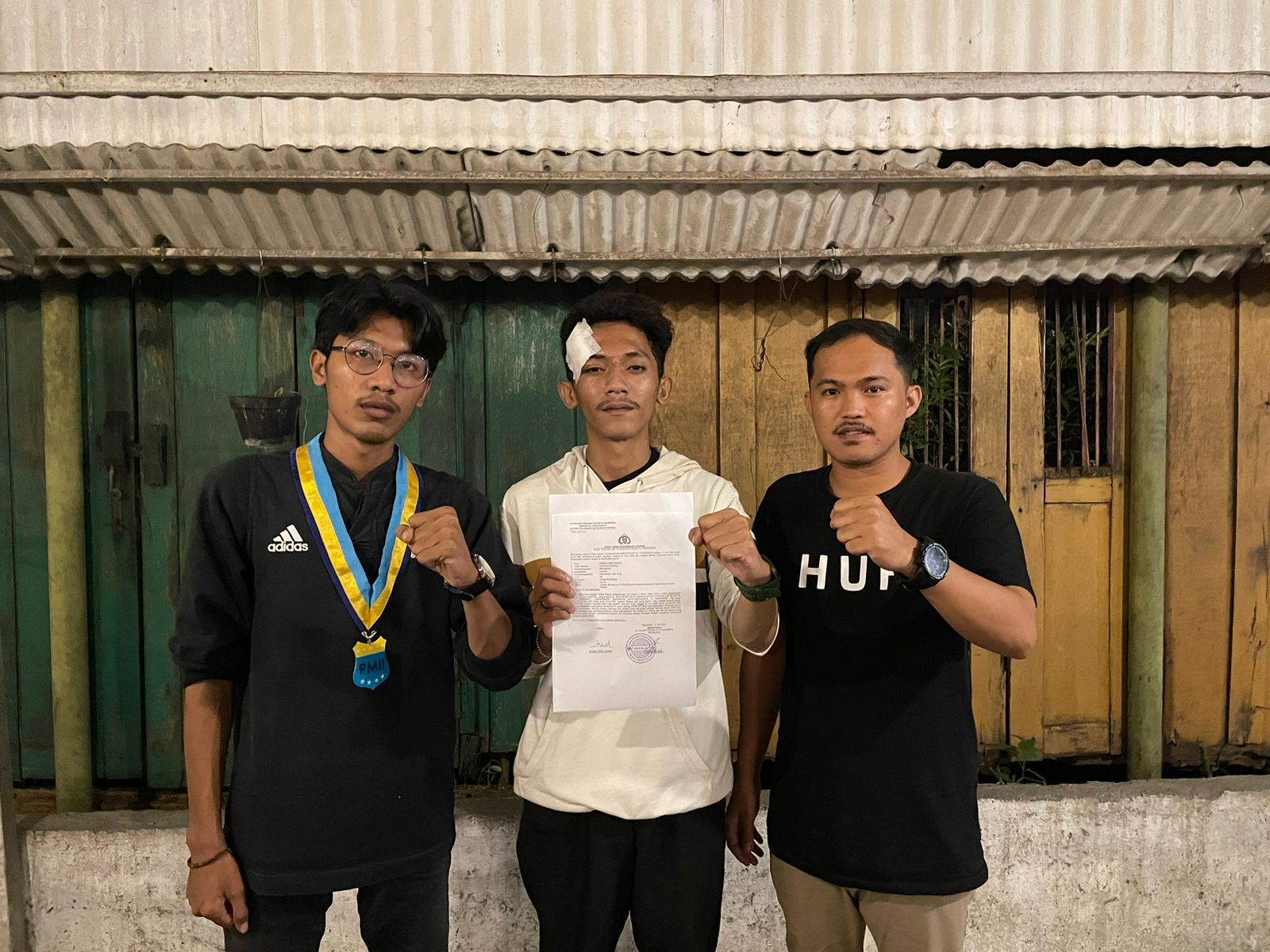 Korban pemukulan melapor ke Polda DIY Selasa malam (11/6/2024).   (PMII DIY Untuk Radar Jogja)