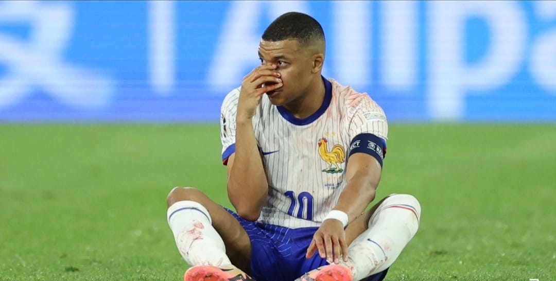 Mbappe mengalami patah tulang hidung saat kemenangan Prancis atas Austria di grup D Euro 2024 (getty)