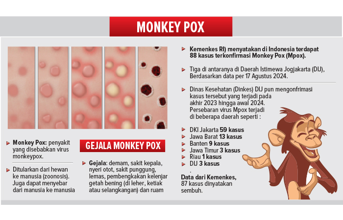 GRAFIS: Monkey Pox di DIJ Terakhir di Awal 2024, Ini Pencegahan Yang Dilakukan Dinkes