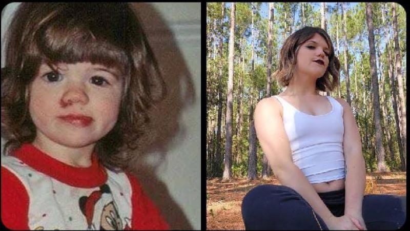 Ashlyn Blocker sejak kecil sudah tidak bisa meraskana sakit, menjadikan kelainannya sebagai salah satu yang sangat jarang terjadi pada manusia.