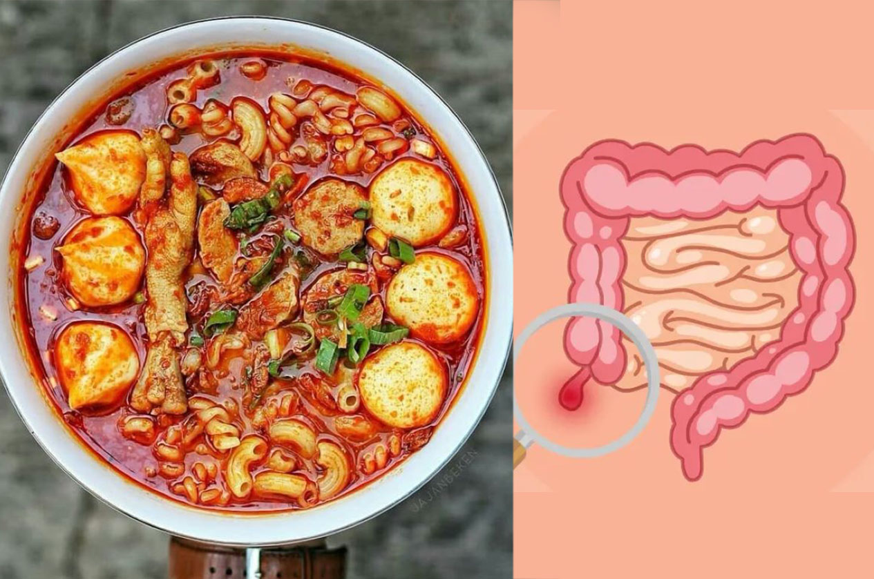 Seblak dapat sebabkan usus buntu? yuk cari tahu!