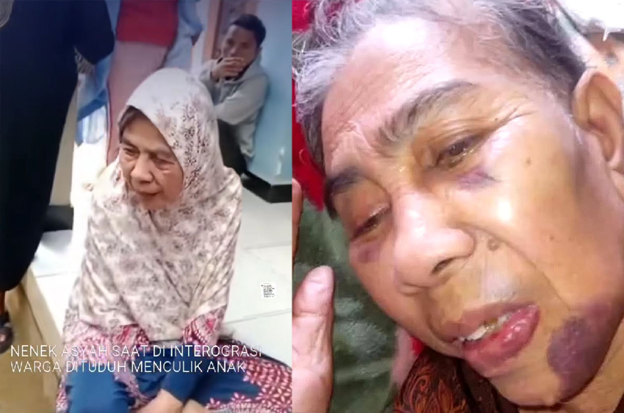 Nenek Asyah (76) korban main hakim sendiri oleh Bapak-bapak di Cianjur. Nenek tersebut dituduh penculik anak.