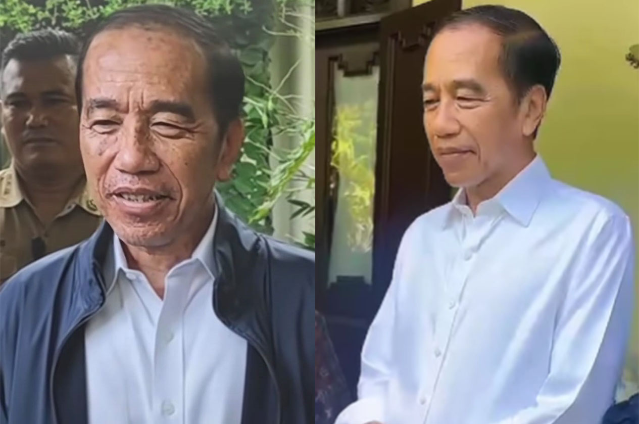 Wajah Jokowi terkena penyakit kulit (kiri) beredar di media sosial. Foto kanan, sebelum terkena penyakit kulit.