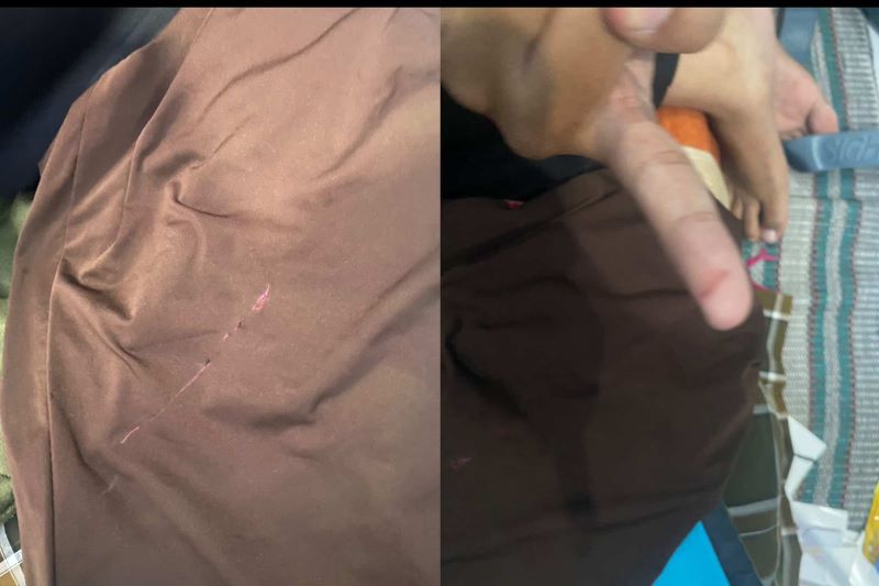 Korban tersangkut benang layangan putus.
