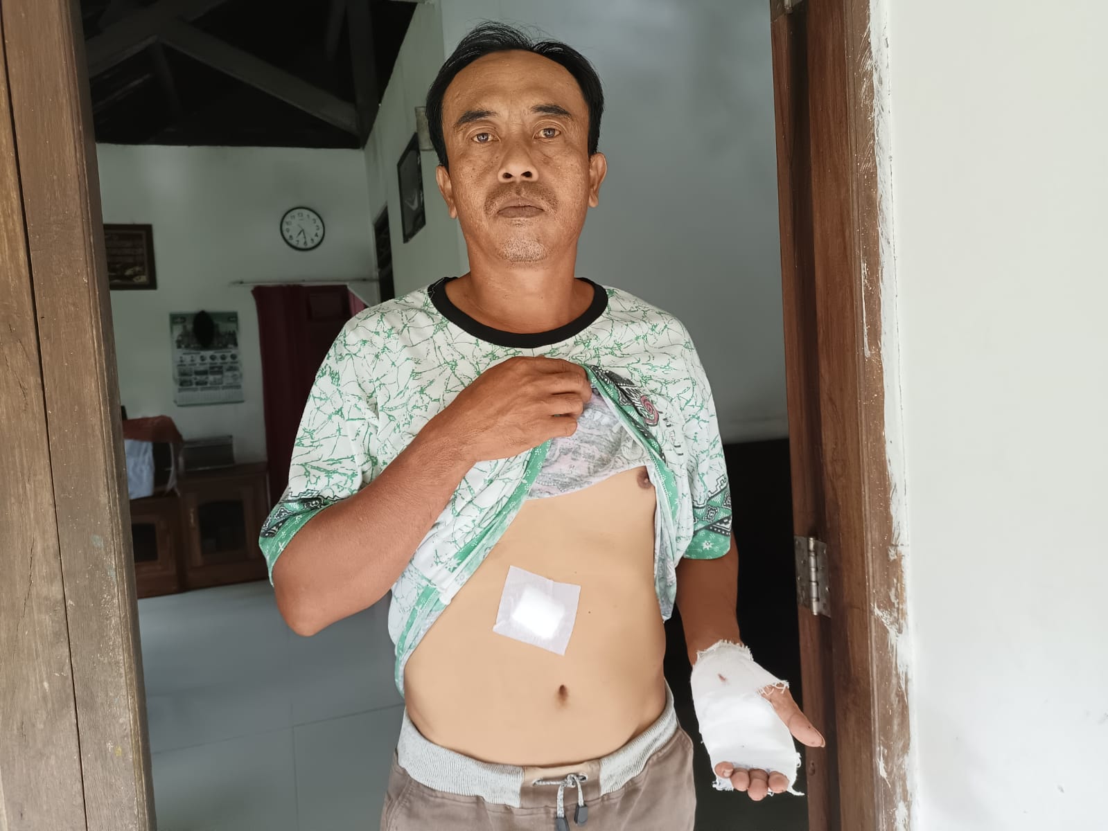 TERLUKA : Pawito, 46, warga Desa Karangpoh, Kecamatan Pejagoan menunjukkan bagian tubuh yang terluka setelah dibacok Orang Dengan Gangguan Jiwa (ODGJ) pada Selasa (9/12) dini hari.