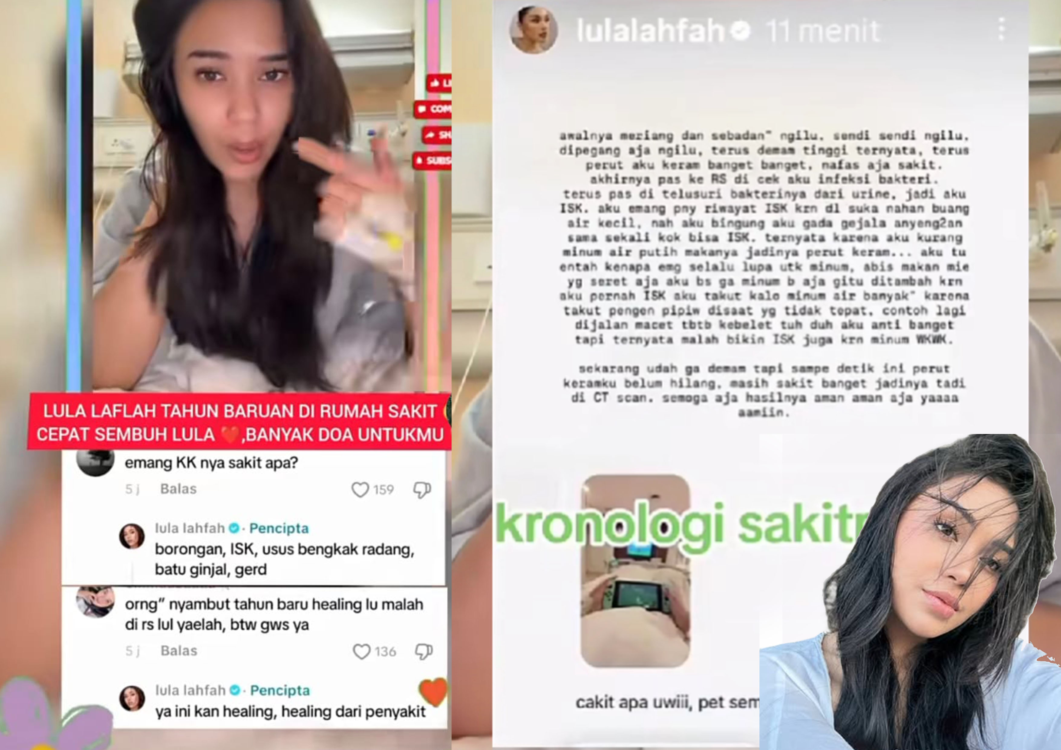 Selebgram sekaligus influencer Lula Lahfah meninggal dunia, pada awal tahun 2026 sempat dirawat dirumah sakit dan sepekan lalu sempat keluhkan sakit.