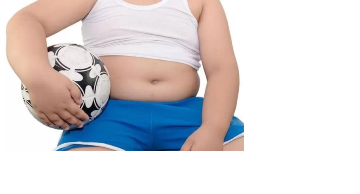 Ilustrasi obesitas pada anak. (Website Kanal Kesehatan FK UGM)