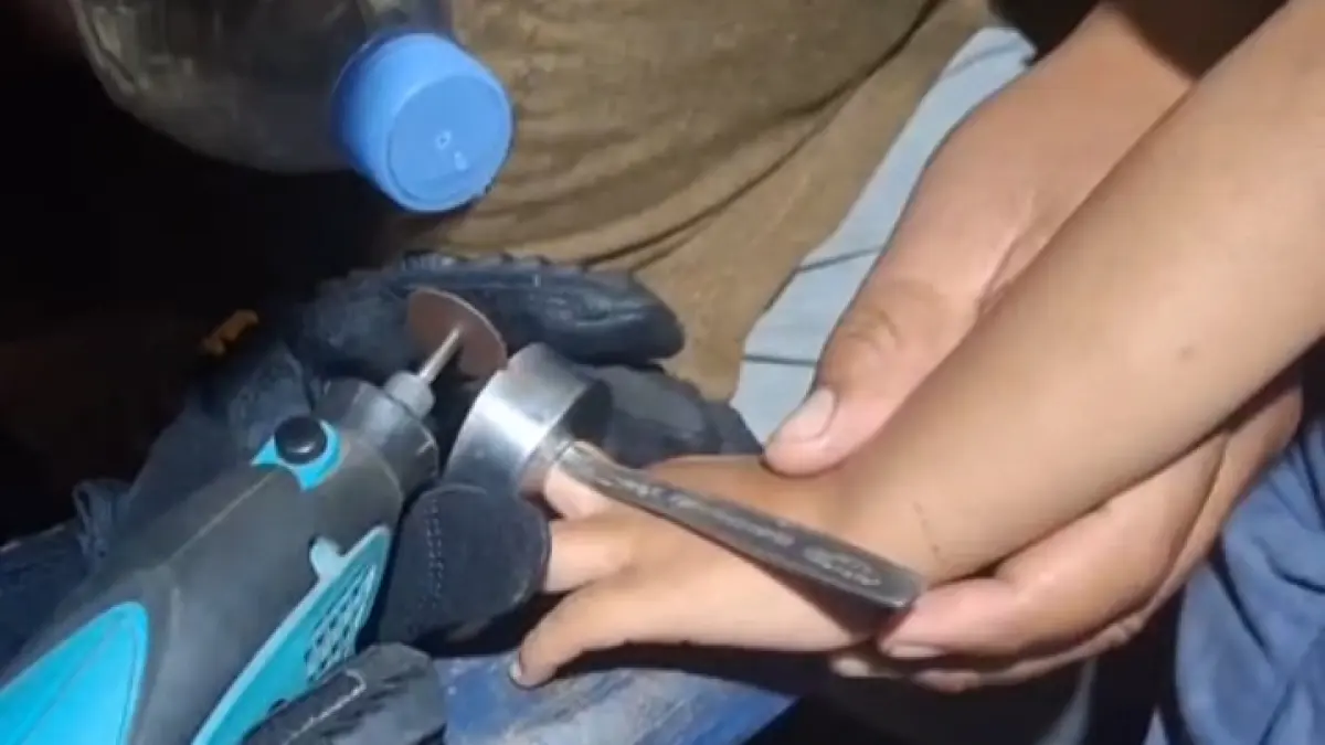 Regu 1 Damkarmat Gunungkidul sedang mengevakuasi jari balita yang terjepit tuto botol - Dokumentasi/Damkarmat Gunungkidul