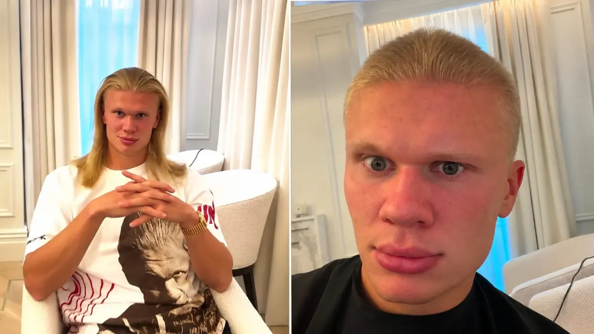 Ig @erling perbedaan haaland sebelum dan sesudah potong rambut
