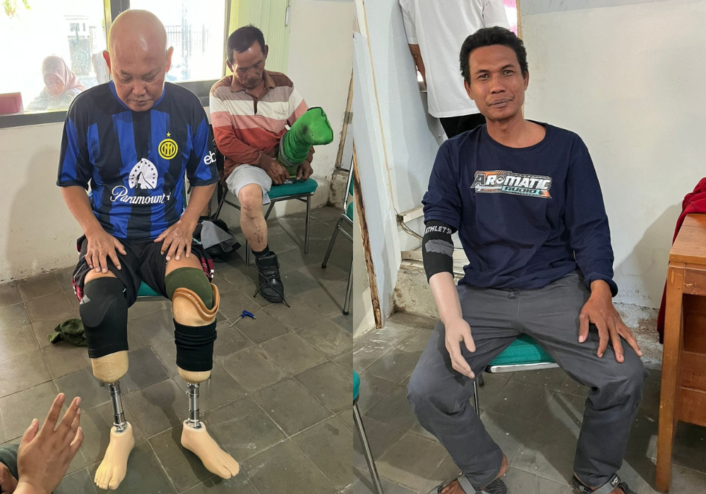 Sejumlah penyandang disabilitas mendapat bantuan kaki palsu hingga tangan palsu di Tulungagung.