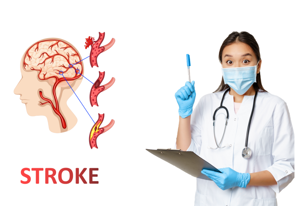 Ilustrasi Penyakit Stroke
