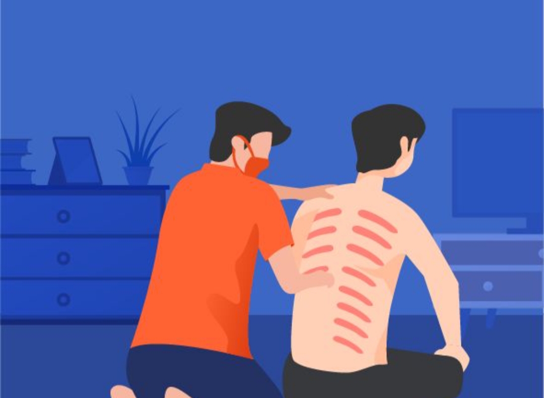 Di tengah gempuran teknologi kesehatan modern, ada satu kebiasaan di Tulungagung yang tetap bertahan dengan kokohnya kerokan.