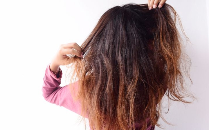 Rambut merupakan mahkota bagi setiap orang, baik pria maupun wanita.