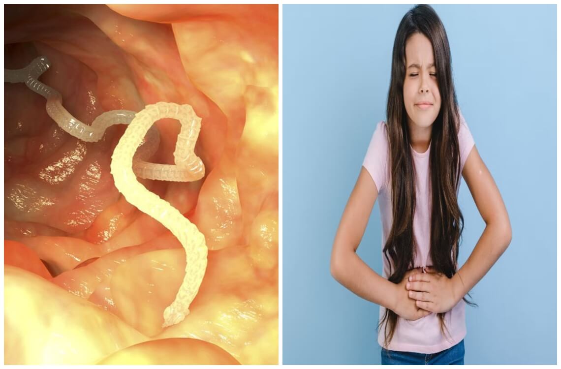 jangan remehkan cacingan, cegah sejak dini dengan pola hidup bersih dan sehat