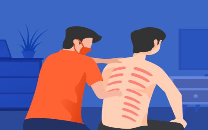 Kerokan bukan sekadar tradisi, tapi juga cara alami yang dipercaya banyak orang untuk meredakan masuk angin dan pegal-pegal. Tapi, benarkah efektif secara medis?