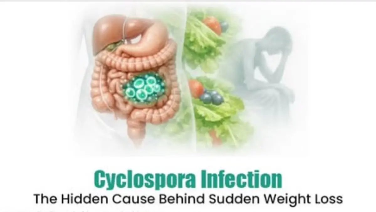 Wabah Cyclospora Taco Bell guncang AS! FDA lacak kontaminasi selada impor Taylor Farms pemicu ribuan kasus infeksi parasit. Simak fakta lengkap dan imbauannya di sini! (Pinterest)