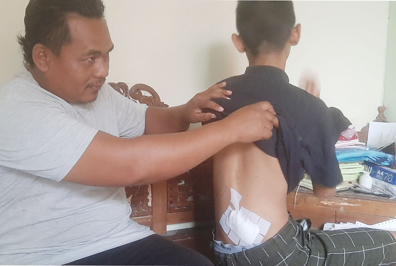 DIPERBAN: Kondisi korban pembegalan, RD, saat ditemui di rumahnya di Jalan Sememi Gang Asri VI, Surabaya. (MAHRUS/RADAR SURABAYA)