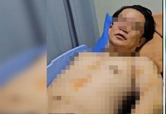 Yusra Valentino, 46, warga Perumahan Dian Istana, Wiyung, Surabaya, diduga dianiaya oleh mantan istrinya. (ISTIMEWA)