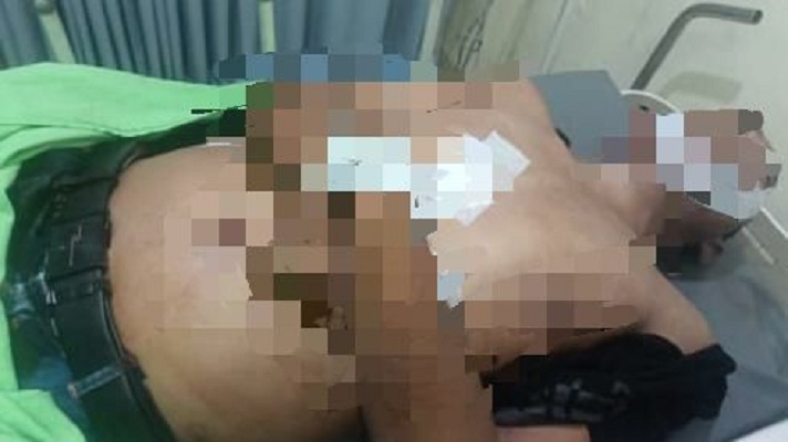 PENUH LUKA: FA menjadi korban mengeroyokan yang diduga dilakukan oleh lima orang di parkiran sebuah diskotik di Jalan Kenjeran, Surabaya, Minggu (5/11). (IST)