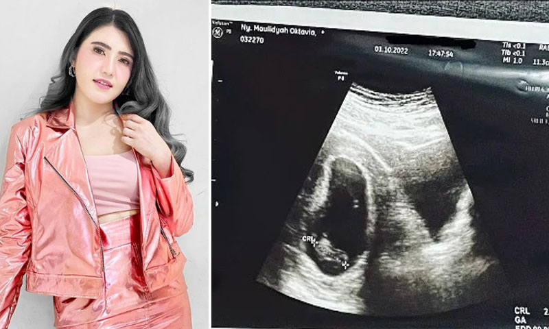 CALON IBU: Via Vallen menunjukkan janin hasil pemeriksaan USG kehamilannya.
