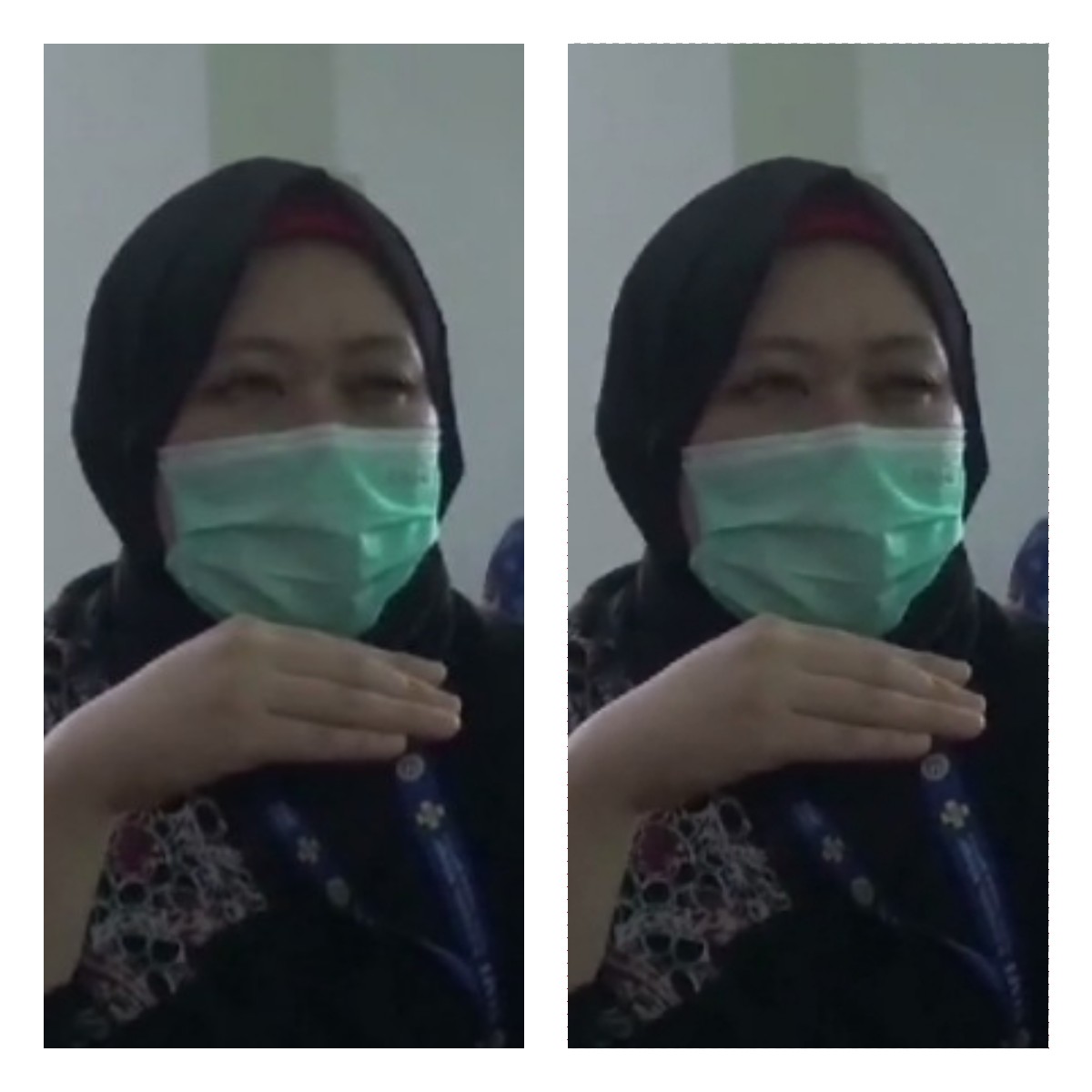 dr. Hastika Saraswati saat menjelaskan kondisi korban kebakaran rumah produksi roti di Gresik yang saat ini dirujuk di RSUD dr Soetomo Surabaya (Rahmat Sudrajat/Radar Surabaya).