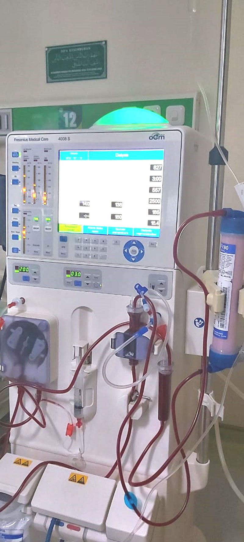 Peralatan hemodialisa yang dimiliki RSI Ahmad Yani.