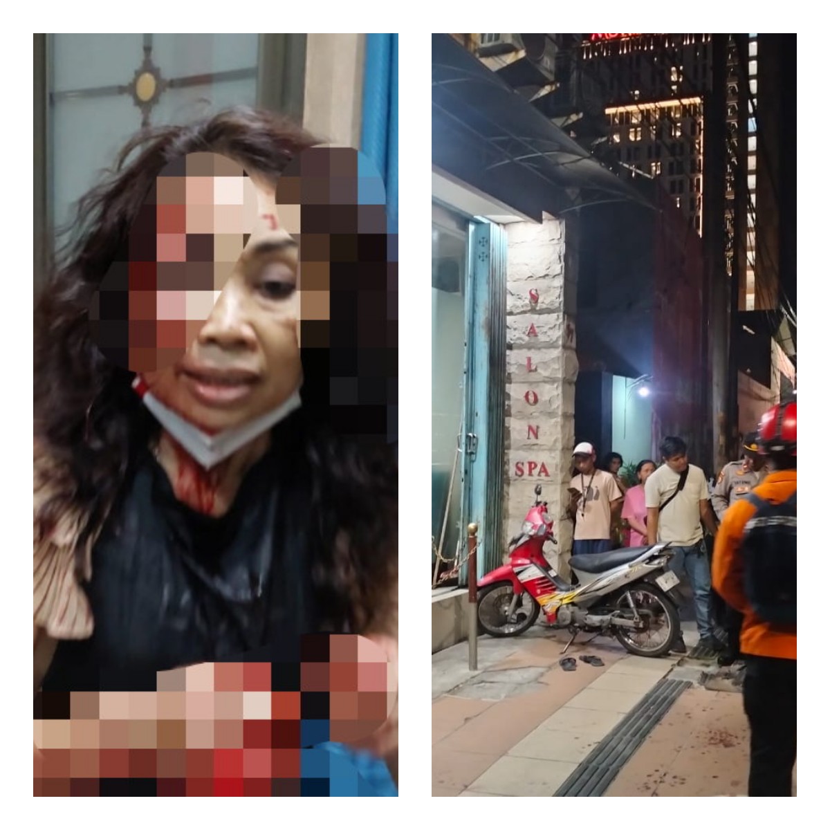 Kondisi Mujayani, 53, pemilik salon dan spa di frontage road Jalan Ahmad Yani, Margorejo mengalami luka parah setelah dibacok pelaku pada Sabtu (13/7). (IST(