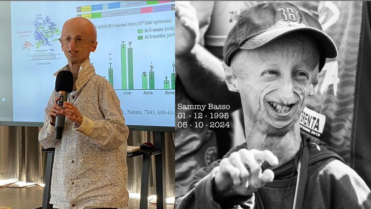 Potret Sammy Basso semasa hidupnya mensosialisasikan Progeria ke berbagai negara.