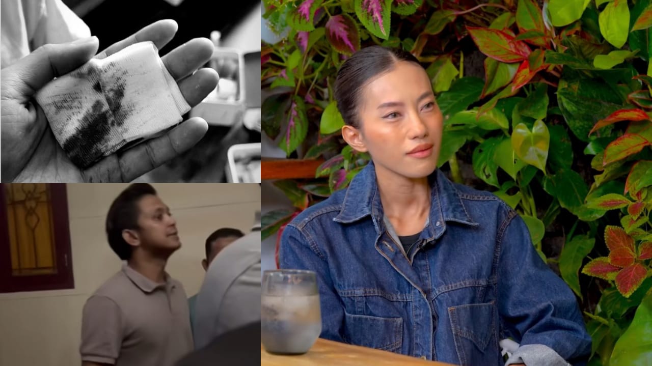 Foto sang mantan suami saat melabrak ke rumah orang tua Fira dan bukti kekerasan yang dialami Enzo (foto kiri) dan foto Alfira Firina dalam podcast Denny Sumargo.