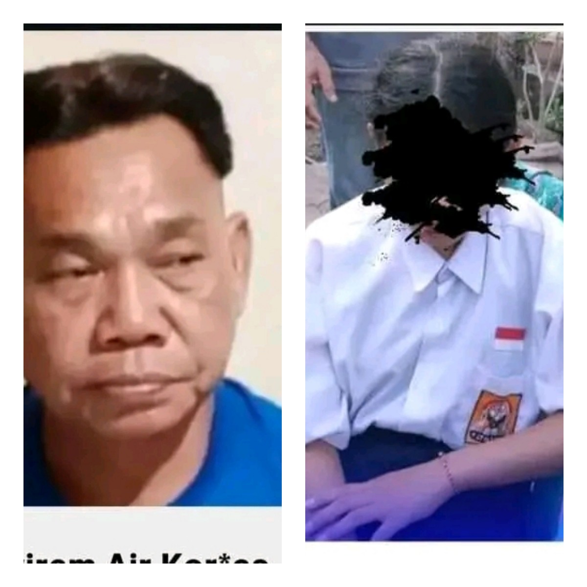 Charles tega menyiram air keras ke wajah siswi SMP di Lembata gara-gara cintanya ditolak. (IST)