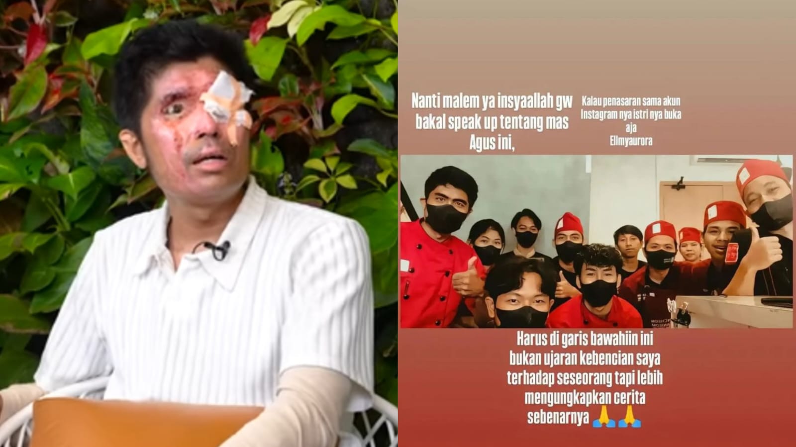 Agus Salim (foto kiri) korban penyiraman air keras saat diundang ke Podcast Densu dan  karyawan restoran yang diunggah mantan rekan kerja Agus (foto kanan).