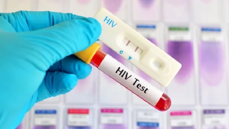 Ilustrasi tes HIV/AIDS.